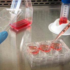 Gloved hand working with cell culture samples in a lab setting.